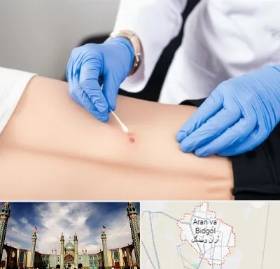 متخصص زخم بستر در آران و بیدگل