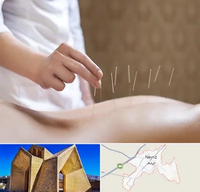 درای نیدلینگ در نی ریز