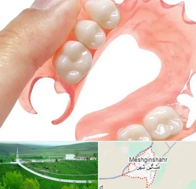 پروتز متحرک دندان در مشگین شهر