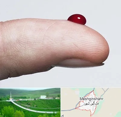 مرکز فصد خون در مشگین شهر