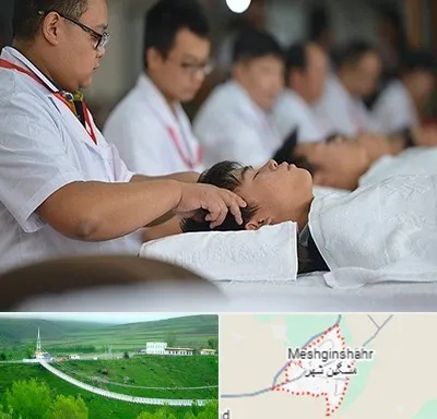 طب چینی در مشگین شهر
