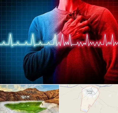نوار قلب در گرمسار
