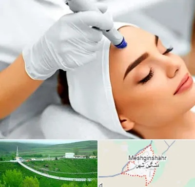 آموزش مزوتراپی در مشگین شهر