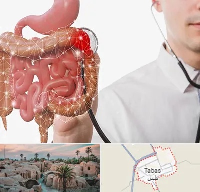 دکتر سرطان روده بزرگ در طبس