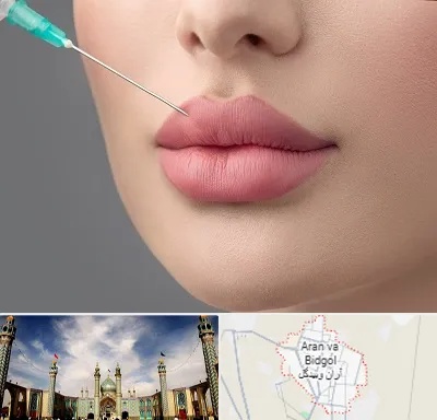 کلینیک ژل لب روسی در آران و بیدگل
