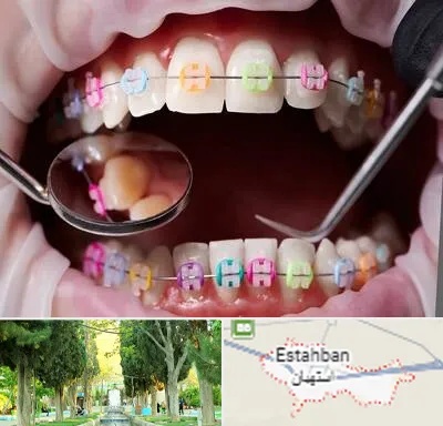 متخصص ارتودنسی در استهبان