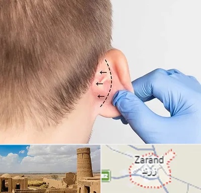 عمل زیبایی گوش در زرند