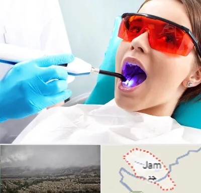 جراحی لثه با لیزر در جم