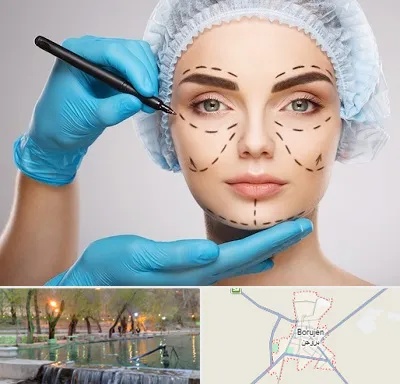 جراح فک و صورت در بروجن