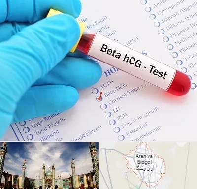 آزمایشگاه بارداری در آران و بیدگل