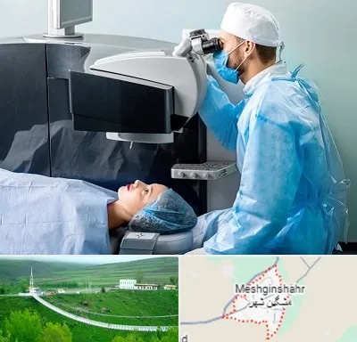 مرکز لیزیک چشم در مشگین شهر