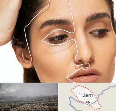 عمل بینی اقساطی در جم