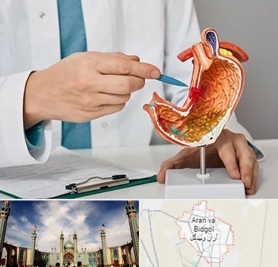 دکتر سرطان معده در آران و بیدگل