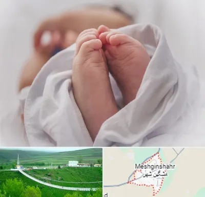فوق تخصص تعیین جنسیت در مشگین شهر