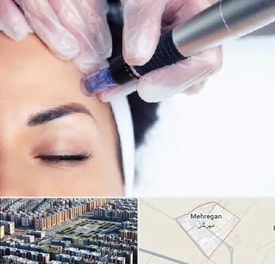 کلینیک مزوتراپی صورت در مهرگان