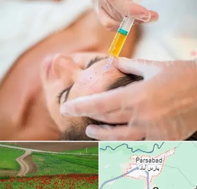 پی آر پی در پارس آباد