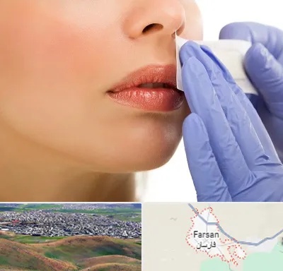 اپیلاسیون صورت در فارسان