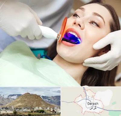 دندانپزشکی بدون درد در گراش