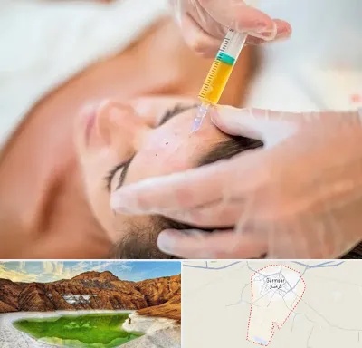 پی آر پی در گرمسار