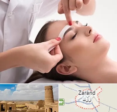 اپیلاسیون در زرند