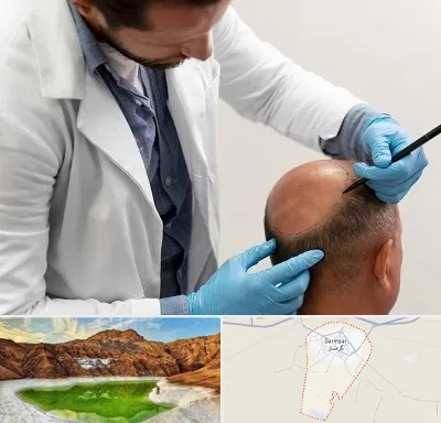 کاشت مو به روش تکثیری در گرمسار