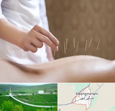 درای نیدلینگ در مشگین شهر
