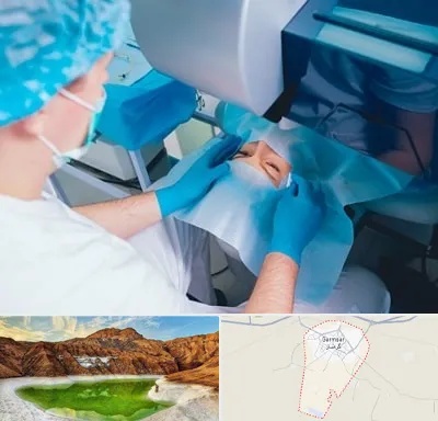 دکتر عمل لازک چشم در گرمسار