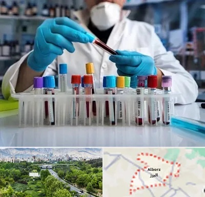 آزمایشگاه خون در البرز