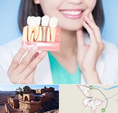 متخصص ایمپلنت در قائن