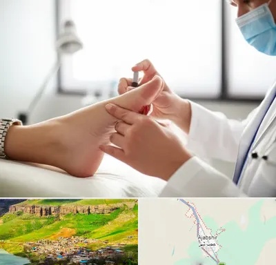 متخصص زخم دیابت در عجب شیر