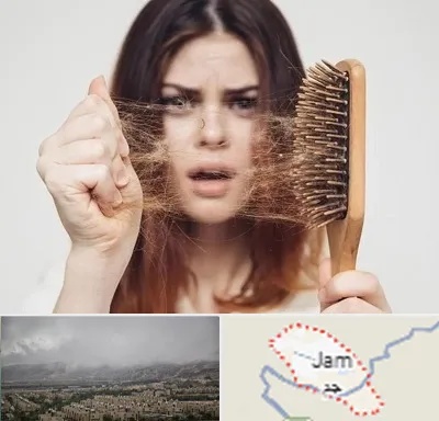 دکتر ریزش مو در جم