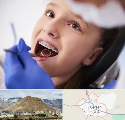 دکتر ارتودنسی کودکان در گراش