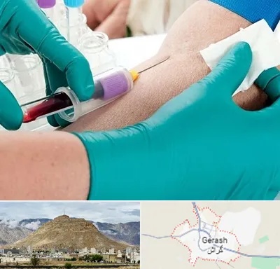 آزمایشگاه در منزل در گراش