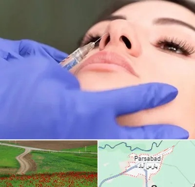 هیالاز در پارس آباد