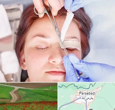 جراحی پلک افتاده در پارس آباد