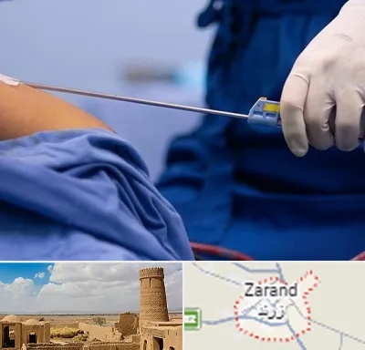 پیکر تراشی در زرند