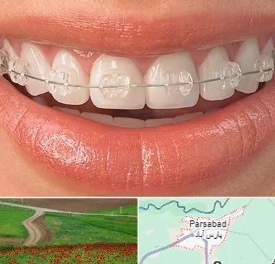 ارتودنسی اقساطی در پارس آباد