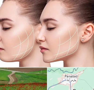 جراحی بوکال فت در پارس آباد