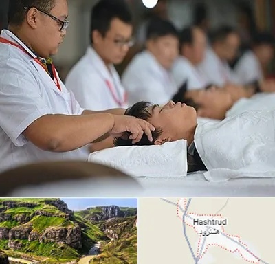 طب چینی در هشترود