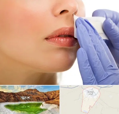 اپیلاسیون صورت در گرمسار