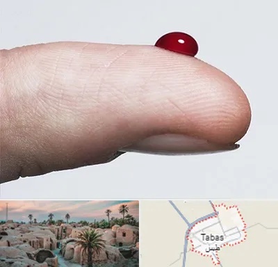 مرکز فصد خون در طبس