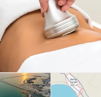 دستگاه لاغری در بندر کنگان