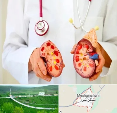 دکتر سنگ کلیه در مشگین شهر