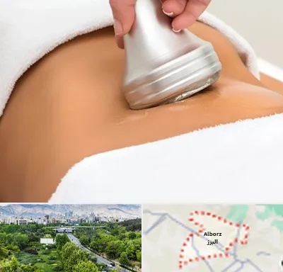 دستگاه لاغری در البرز