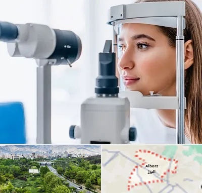 فوق تخصص شبکیه در البرز