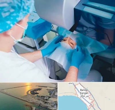 دکتر عمل لازک چشم در بندر کنگان