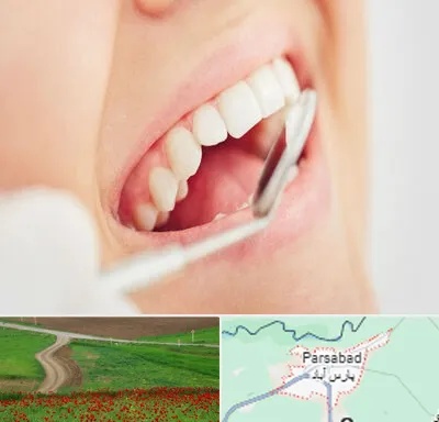اصلاح طرح لبخند در پارس آباد