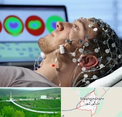 مرکز نوار مغز در مشگین شهر