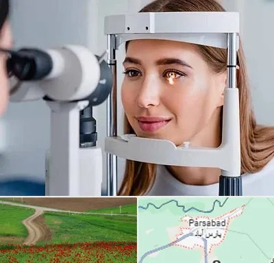 دکتر قوز قرنیه در پارس آباد