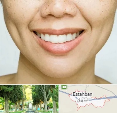 عمل چال گونه در استهبان